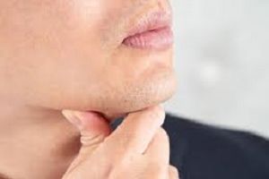 男性のヒゲ脱毛